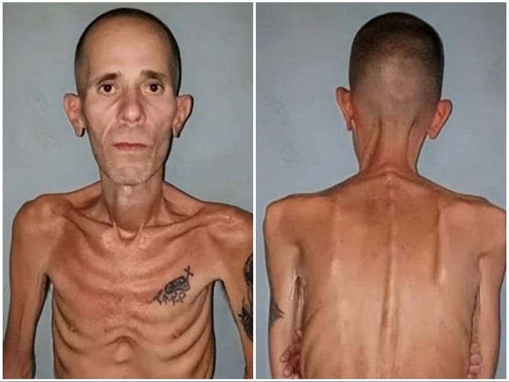 Denuncian estado de salud de excarcelado tras condena por protestas del 11J